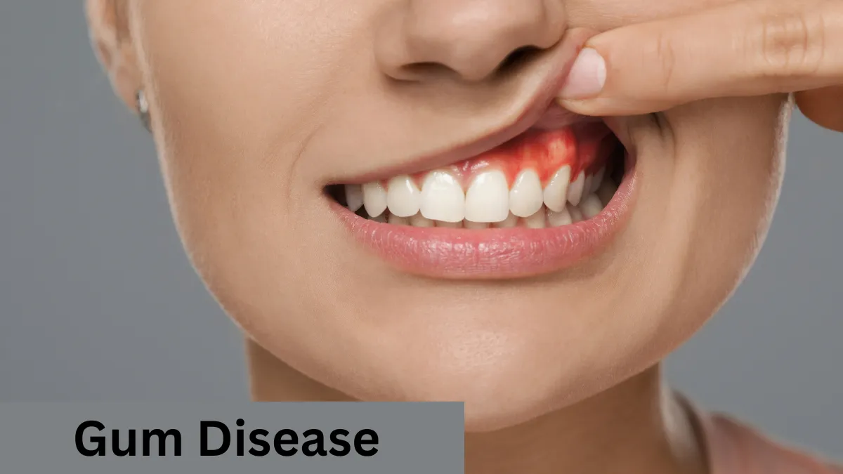 Can Gum Disease Kill You? Facts You Can’t Ignore!